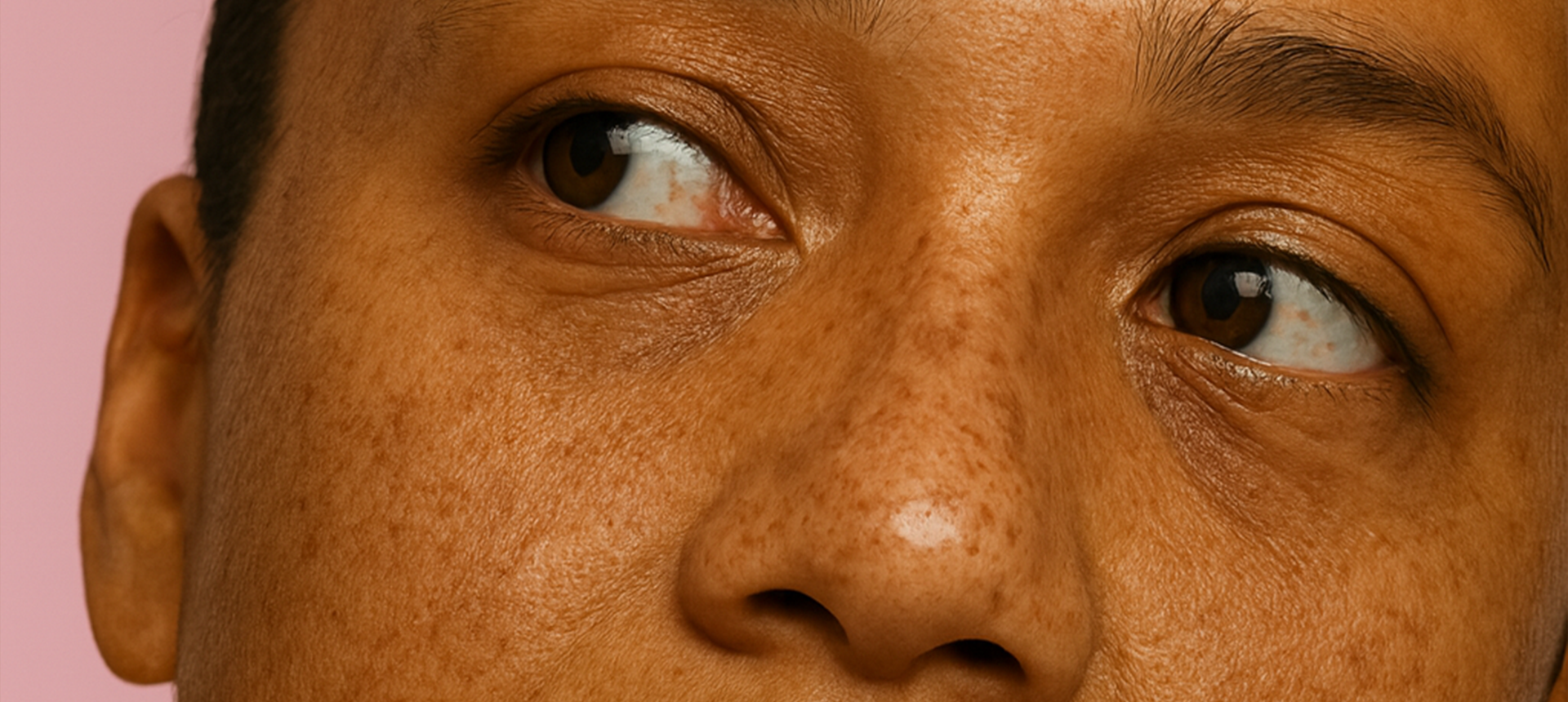 Dry & Dehydrated Skin - Shéeba London