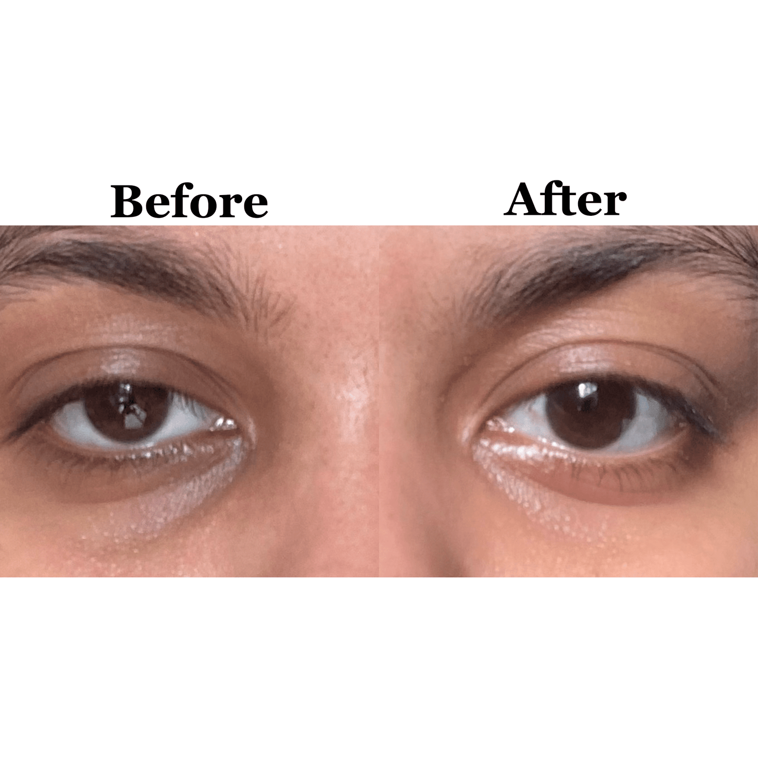 Brightening Eye Gel with Vitamin C & Collagen - Shéeba London
