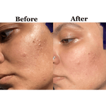 Glow Cleanser with Niacinamide & Prebiotics - Shéeba London