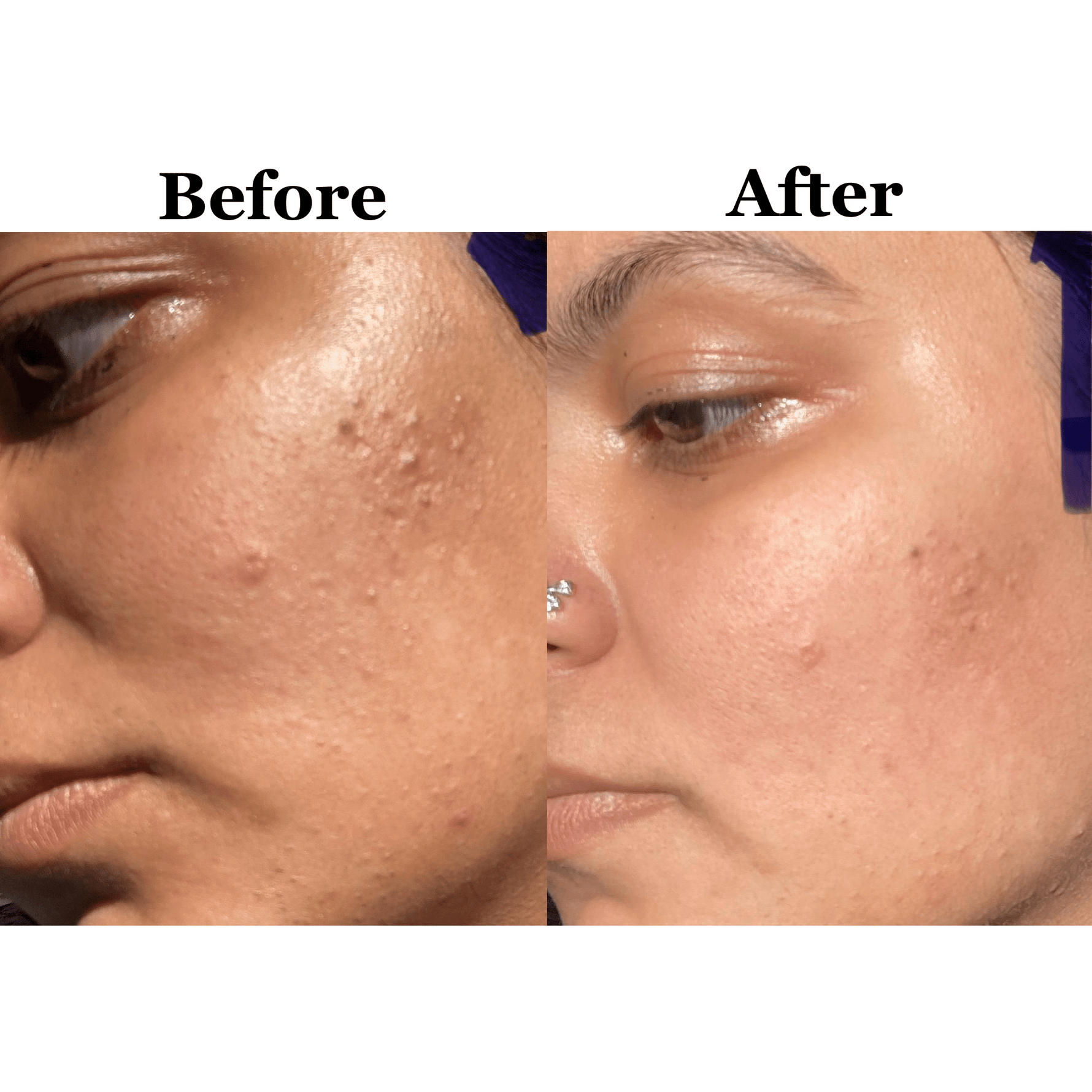 Glow Cleanser with Niacinamide & Prebiotics - Shéeba London