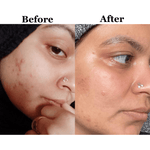Glow Cleanser with Niacinamide & Prebiotics - Shéeba London