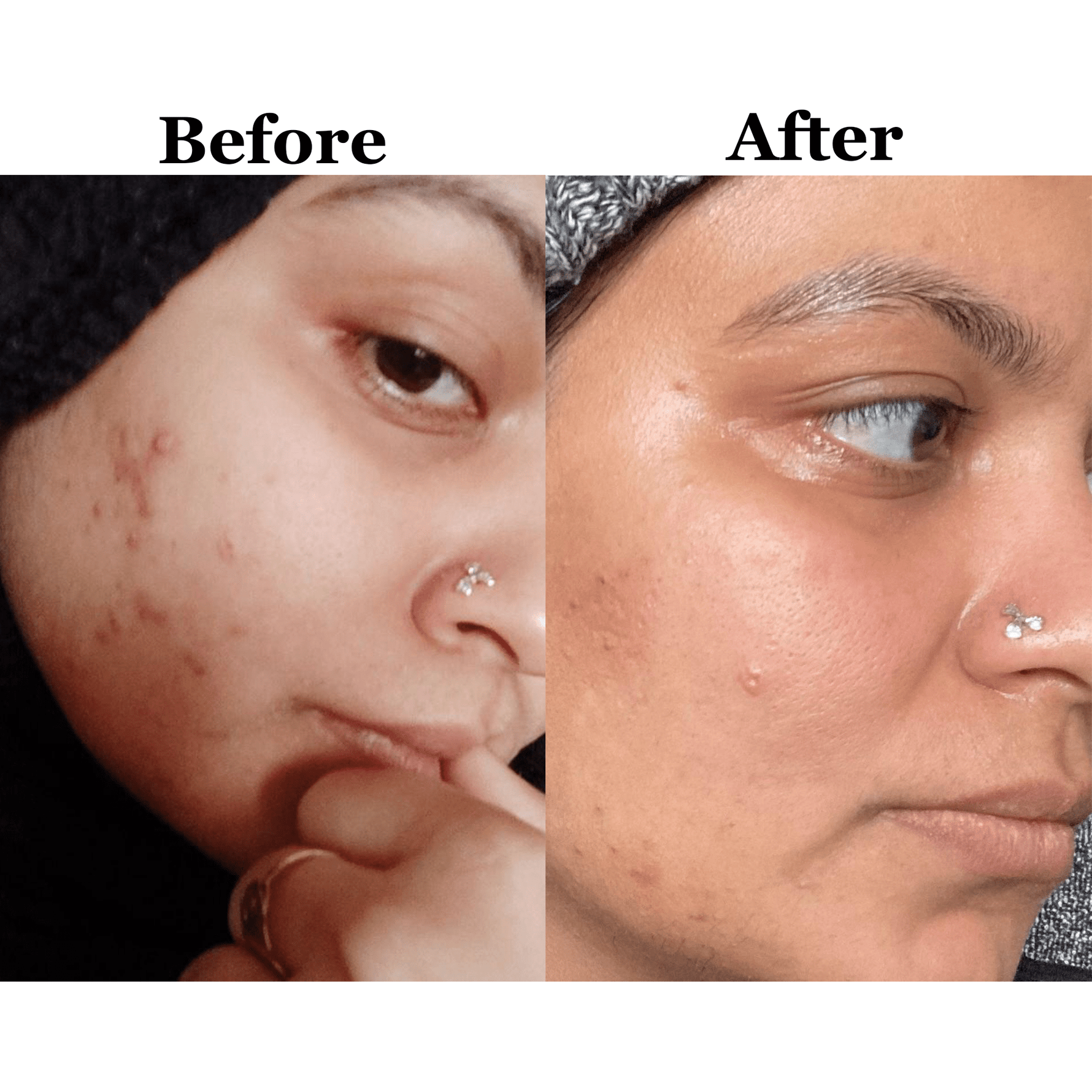 Glow Cleanser with Niacinamide & Prebiotics - Shéeba London